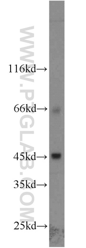 [24066-1-AP-20UL] SLC36A4 Polyclonal antibody