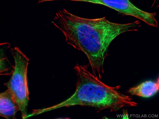 [24072-1-AP-20UL] Rac1 Polyclonal antibody