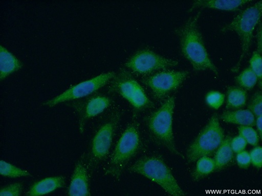 [24080-1-AP-150UL] ANKLE1 Polyclonal antibody