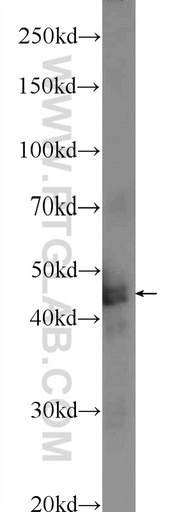 [24092-1-AP-150UL] TMEM201 Polyclonal antibody