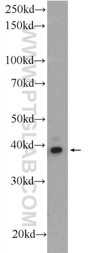 [24103-1-AP-150UL] PCGF6 Polyclonal antibody