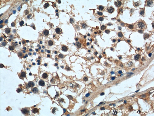 [24105-1-AP-150UL] MAGEF1 Polyclonal antibody
