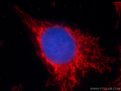 [24127-1-AP-150UL] SOD2 Polyclonal antibody