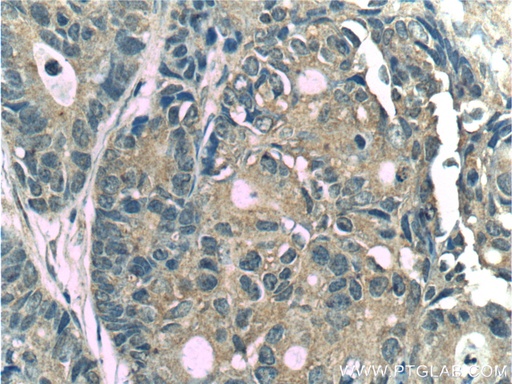 [24133-1-AP-150UL] CYS1 Polyclonal antibody