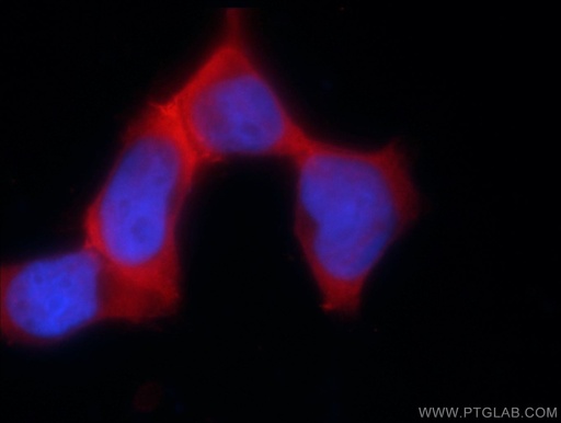 [24142-1-AP-150UL] PSMC3 Polyclonal antibody