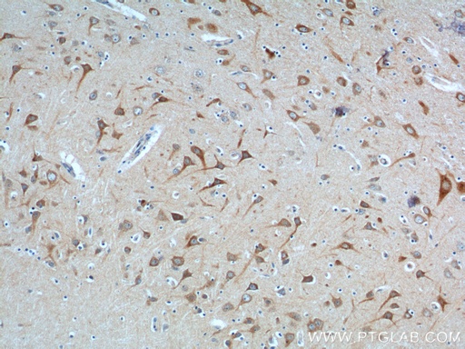 [24162-1-AP-20UL] NPBWR2 Polyclonal antibody