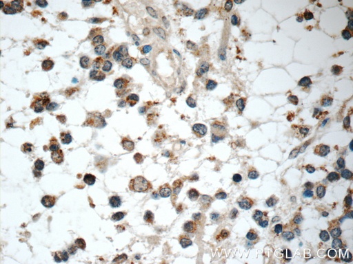 [24173-1-AP-20UL] IL-1F6/IL-36 Alpha Polyclonal antibody