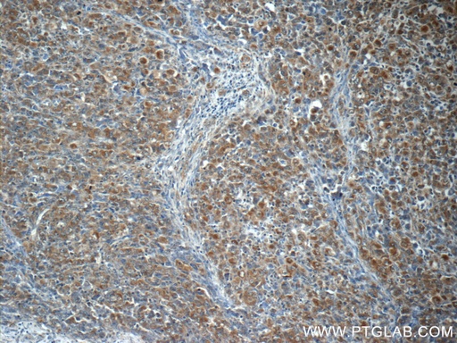 [24184-1-AP-20UL] ALK/CD246 Polyclonal antibody