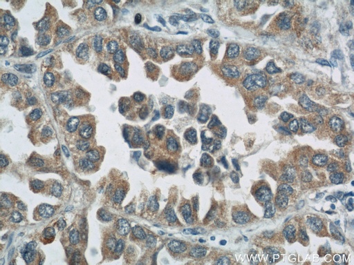 [24200-1-AP-150UL] ROMO1 Polyclonal antibody