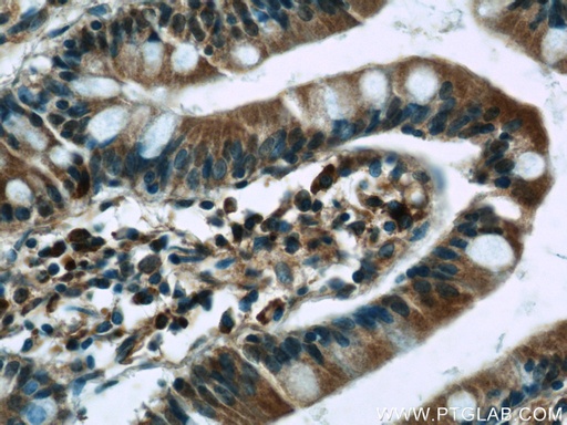 [24201-1-AP-20UL] WNT6 Polyclonal antibody