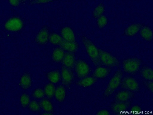 [24202-1-AP-20UL] LUC7L2 Polyclonal antibody