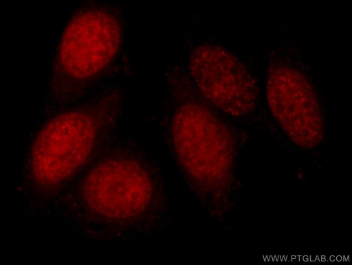 [24206-1-AP-20UL] DNMT1 Polyclonal antibody