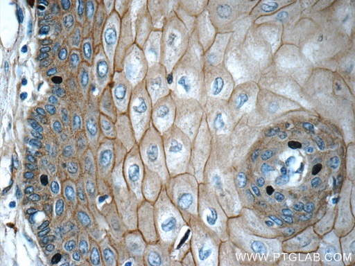 [24215-1-AP-150UL] GJB6 Polyclonal antibody