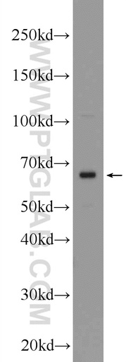 [24272-1-AP-20UL] Frizzled 2 Polyclonal antibody