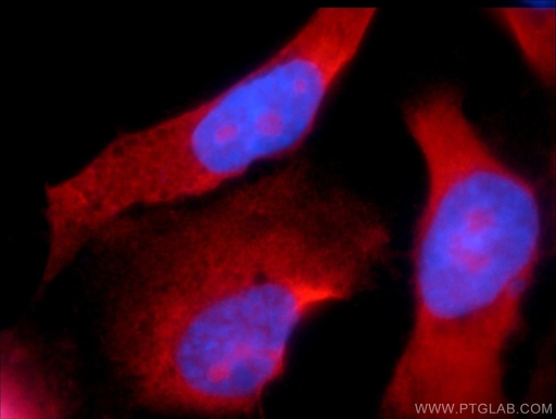 [24276-1-AP-20UL] CCDC104 Polyclonal antibody