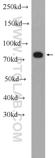 [24280-1-AP-20UL] MEFV Polyclonal antibody