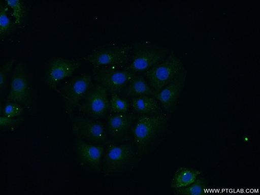 [24282-1-AP-150UL] FBXO28 Polyclonal antibody