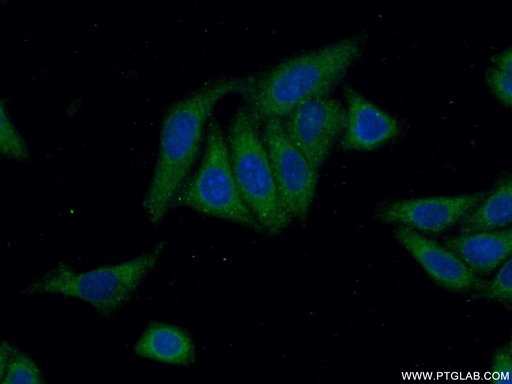 [24283-1-AP-150UL] ANKRD53 Polyclonal antibody