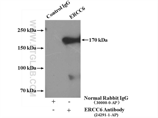 [24291-1-AP-20UL] ERCC6/CSB Polyclonal antibody