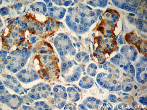 [24294-1-AP-150UL] peptide YY Polyclonal antibody