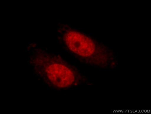 [24296-1-AP-20UL] EFCAB5 Polyclonal antibody