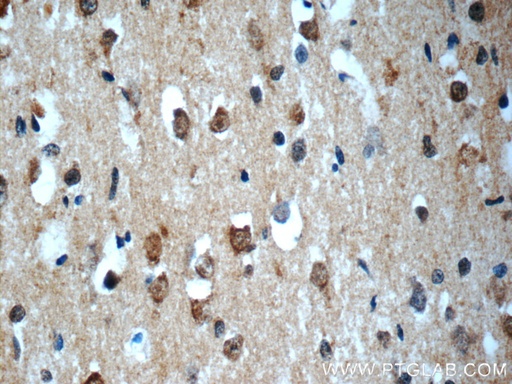 [24297-1-AP-20UL] SNRNP48 Polyclonal antibody