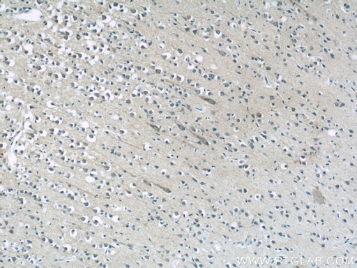 [24298-1-AP-150UL] MFSD8 Polyclonal antibody
