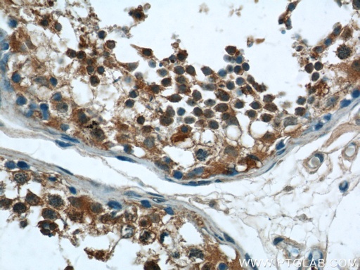 [24302-1-AP-150UL] RNF17 Polyclonal antibody