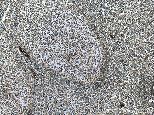 [24304-1-AP-150UL] cIAP2 Polyclonal antibody
