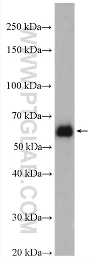 [24310-1-AP-20UL] EEPD1 Polyclonal antibody