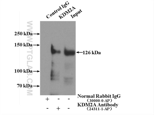 [24311-1-AP-20UL] KDM2A Polyclonal antibody