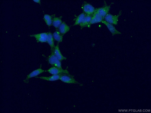 [24312-1-AP-20UL] CAMK1 Polyclonal antibody