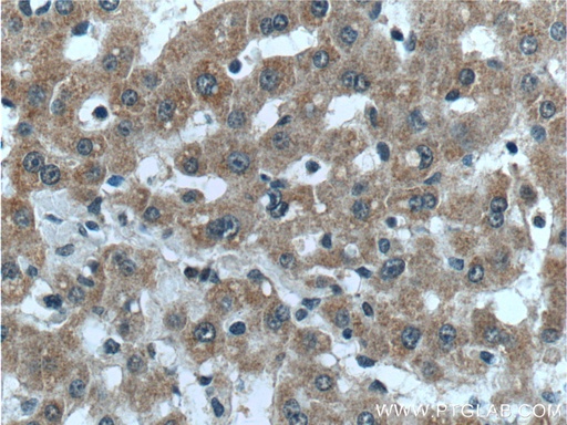 [24313-1-AP-20UL] LYSMD3 Polyclonal antibody