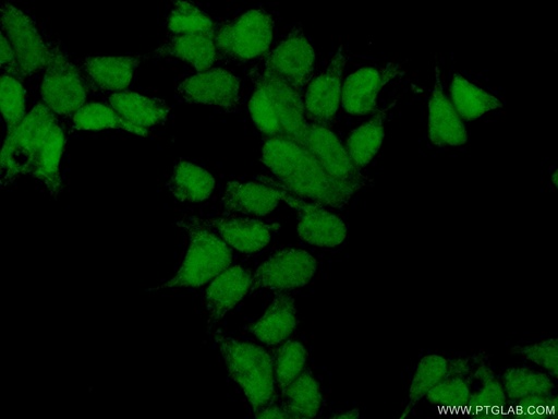 [24319-1-AP-150UL] C5orf24 Polyclonal antibody
