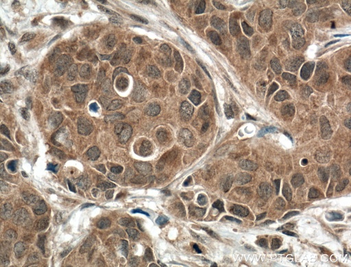 [24320-1-AP-20UL] DGKB Polyclonal antibody