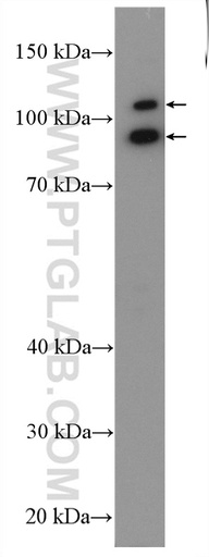 [24323-1-AP-150UL] ABTB2 Polyclonal antibody