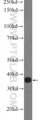 [24326-1-AP-150UL] ACPT Polyclonal antibody