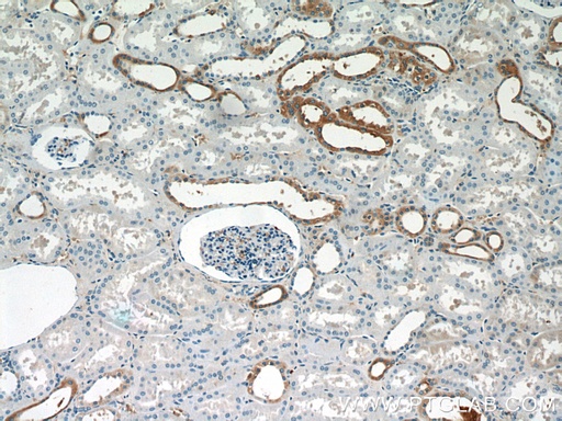[24327-1-AP-150UL] SGLT3/SLC5A4 Polyclonal antibody