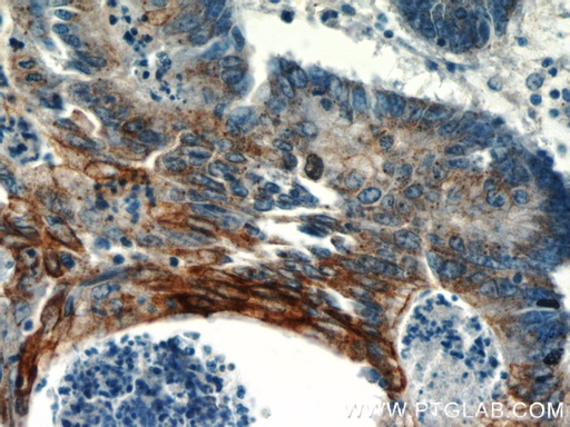 [24331-1-AP-150UL] TMEM9B Polyclonal antibody