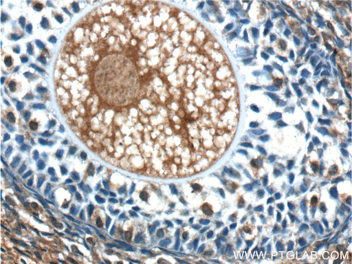 [24333-1-AP-150UL] ANKRD6 Polyclonal antibody