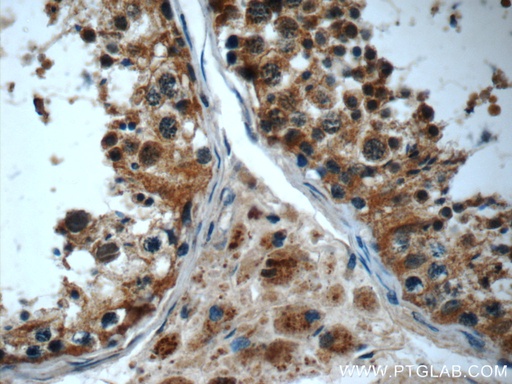 [24338-1-AP-20UL] IFT43 Polyclonal antibody