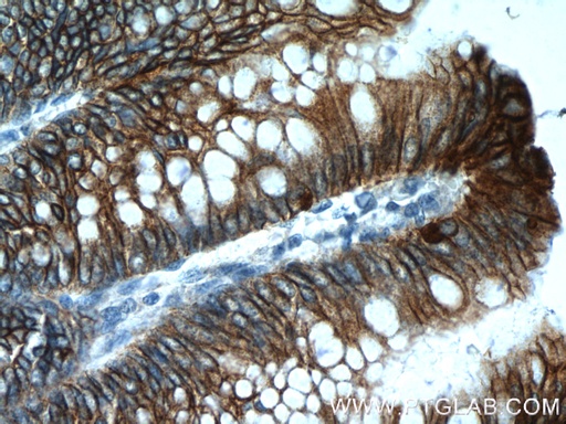 [24339-1-AP-150UL] Cadherin-17 Polyclonal antibody