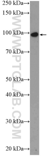 [24340-1-AP-20UL] ZNF366 Polyclonal antibody