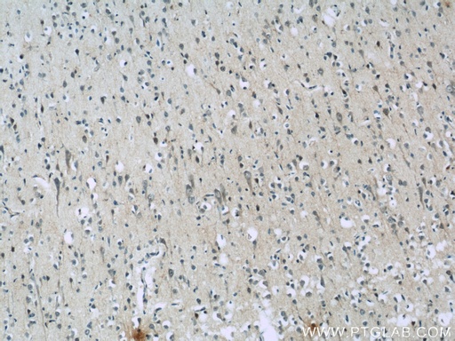[24342-1-AP-20UL] AQR Polyclonal antibody