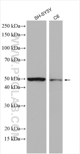 [24343-1-AP-20UL] UGT2A1 Polyclonal antibody