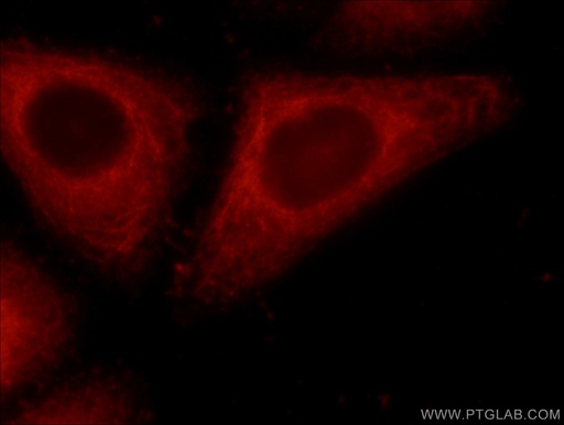 [24344-1-AP-150UL] ERP29 Polyclonal antibody