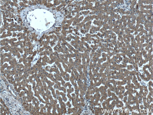 [24351-1-AP-150UL] ABCA8 Polyclonal antibody