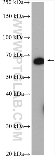 [24354-1-AP-20UL] C7orf31 Polyclonal antibody