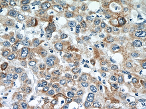 [24361-1-AP-20UL] TMEM25 Polyclonal antibody