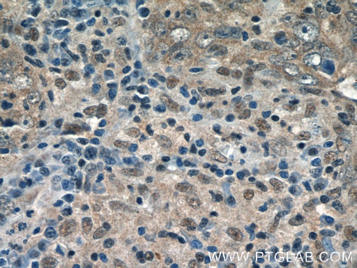 [24366-1-AP-20UL] GPATCH2 Polyclonal antibody